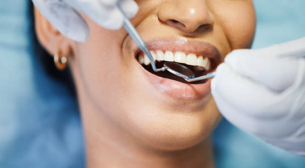 Best Emergency Treatment for Dental Infections or Abscesses in Bellview, FL