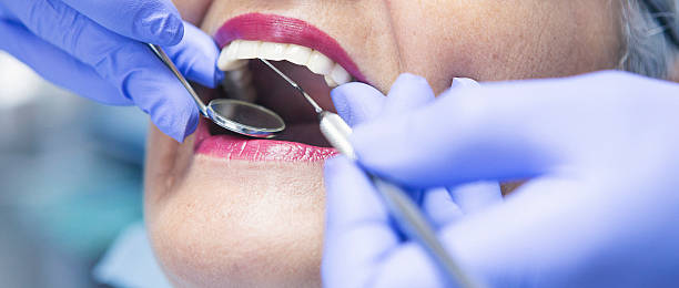 Best Weekend Emergency Dentist in Bellview, FL